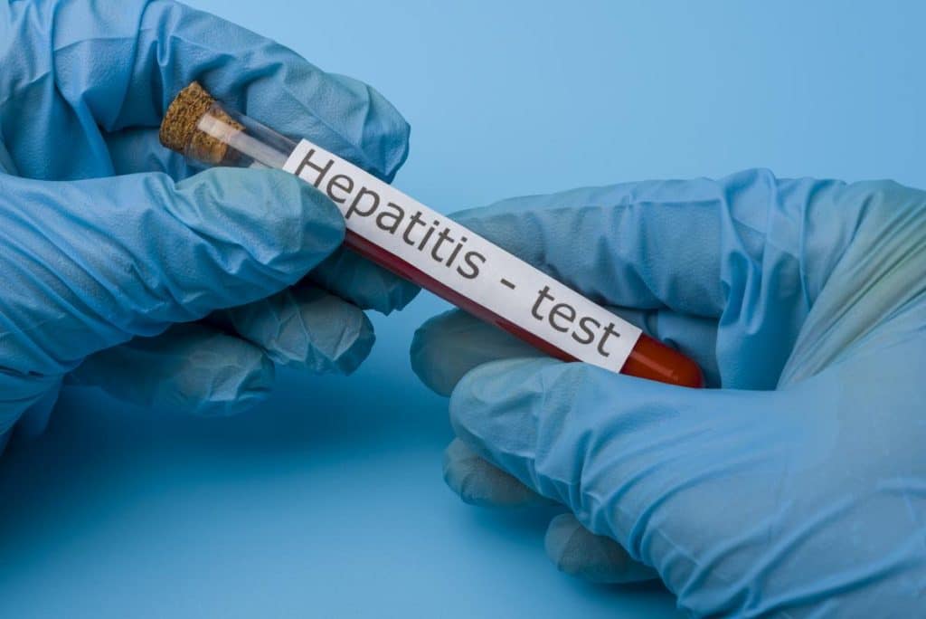 serologie hepatite b negatif​