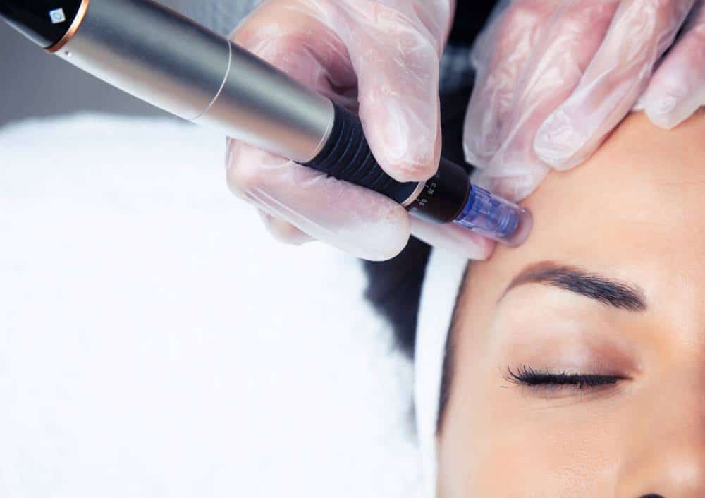 rajeunissement facial chirurgie esthétique